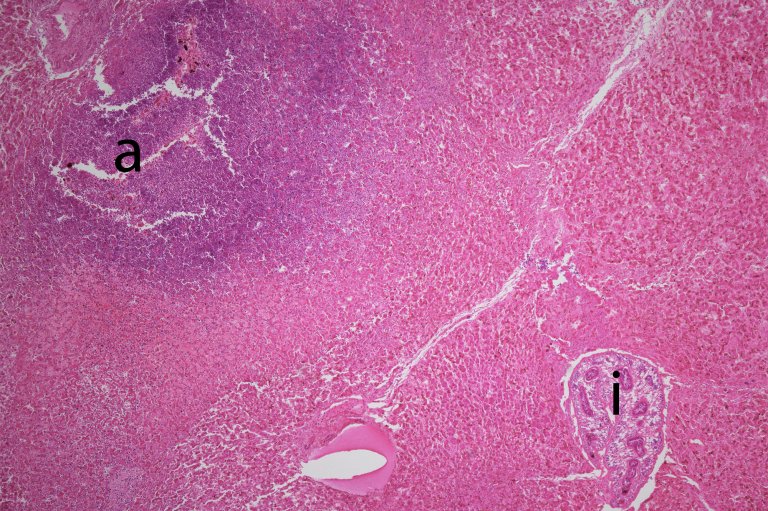 Et mikroskopbilde av en alpakkalever med en liten verkebyll og en Dicrocoelium dendriticum leverikte.