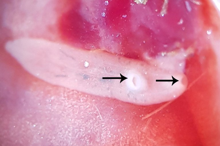 Liten leverikte Dicrocoelium dendriticum på lamalever