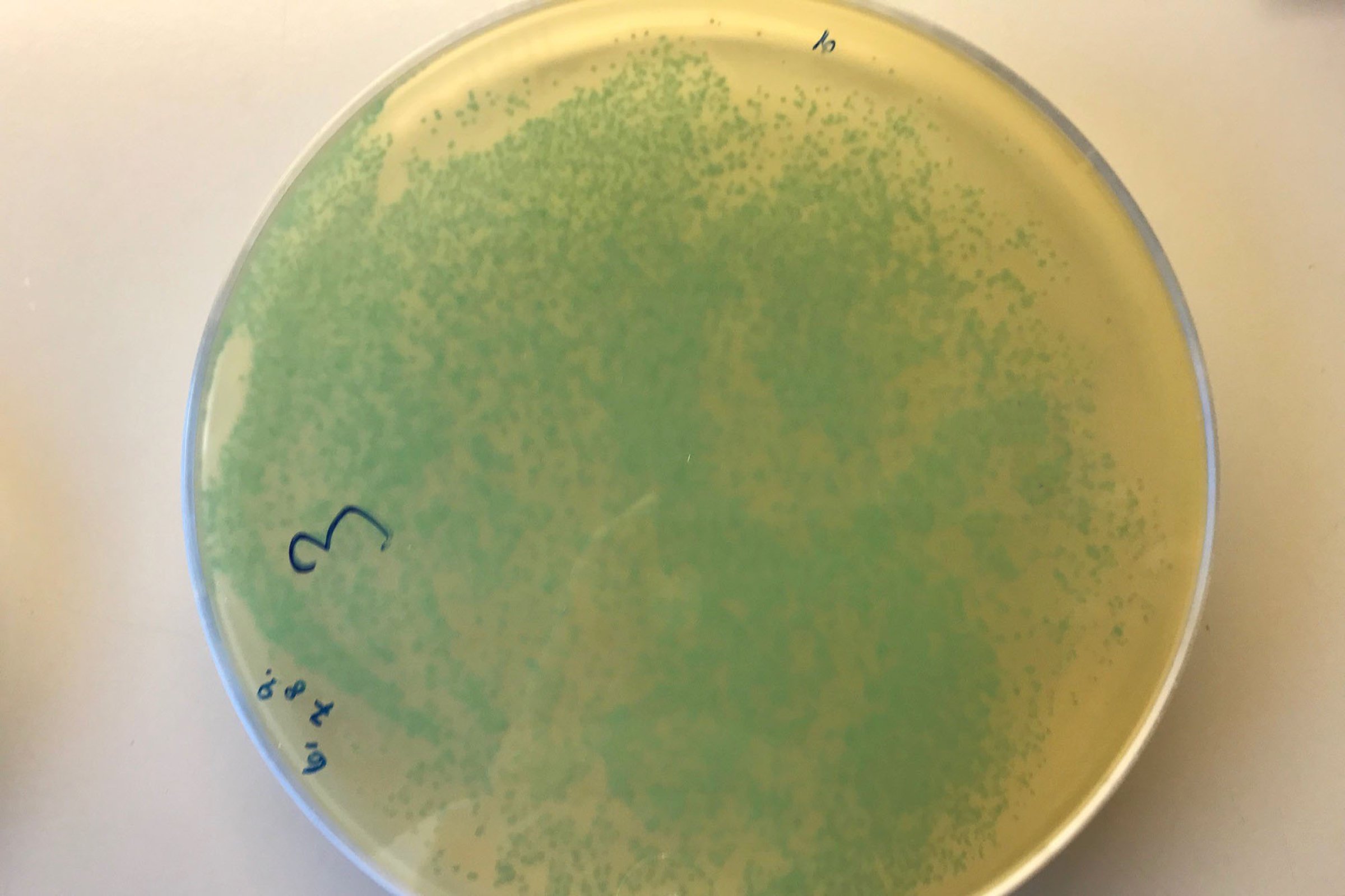 Listeriose er ein sjeldan, men alvorleg sjukdom som hovudsakleg råkar gravide, eldre med svekka helsetilstand og andre personar med nedsett immunforsvar. Foto: Veterinærinstituttet