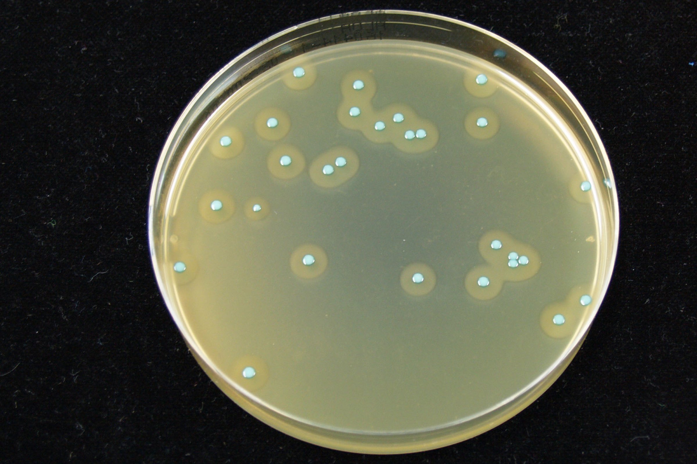 Listeriose er ein sjeldan, men alvorleg sjukdom som hovudsakleg råkar gravide, eldre med svekka helsetilstand og andre personar med nedsett immunforsvar. Foto: Veterinærinstituttet