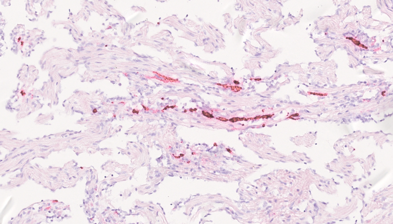 FHR 2023 Figur 6.5.2 CMS ISH PMCV_Camilla Fritsvold.png